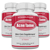 Acnetame Acne Pills- Acne Tame 3 Pack Supplement- Clear Skin Vitamins Pill for Oily Skin Treatment, Hormonal Blemishes, Spots & Cystic Acnes Supplements for Women, Men, Teens & Adults- 180 Tablets