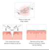 Clozex Emergency Laceration Closures - Repair Wounds Without Stitches. FDA Cleared Skin Closure Device for 2 Individual Wounds Or Combine for Total Length of 3 Inches. Life Happens, Be Ready!