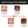 iRestore Essential Laser Hair Growth System - FDA Cleared Hair Loss Treatments for Men & Women & Hair Growth Products for Men with Thinning Hair, Hair Regrowth Treatments Laser Cap, Red Light Therapy