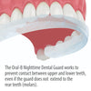 Oral-B Nighttime Dental Guard, Less Than 3-Minutes for Custom Teeth Grinding Protection with Scope Mint Flavor, Standard