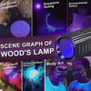 Wood's Lamp pet cat, dog Wood's Black light Flashlight cat Ringworm Detector,Doctor Pet Urine Detector,for Analyzing Skin Dog Cat Care Bed Bug Inspect.