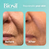 Biosil Collagen Generator - 120 Capsules - with Patented ch-OSA Complex - Generates & Protects Your Own Collagen - GMO Free - 120 Servings