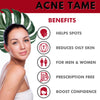 Acnetame Acne Pills- Acne Tame 3 Pack Supplement- Clear Skin Vitamins Pill for Oily Skin Treatment, Hormonal Blemishes, Spots & Cystic Acnes Supplements for Women, Men, Teens & Adults- 180 Tablets