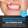 Starlite Smile Gum Light, 32 LED Red & Blue Light Gum Light That Also Helps with Teeth Whitening at Home, Teeth Whitening Accelerator