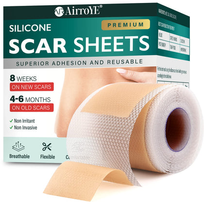 Silicone Scar Sheets,Silicone Scar Tape(1.6