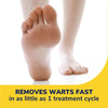 Dr. Scholl's Freeze Away® WART Remover, 12 Applications // Doctor-Proven Freeze Therapy to Remove Common and Plantar Warts Fast, 12 Treatments