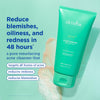 Skinfix Acne+ BHA Cleanser: Multi-Level Pore Resurfacing, Deep Pore & Acne-Fighting Cleanser Helps Reduce Blemish Size, Redness & Excess Oil, 5 Fl Oz