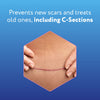 ScarAway Advanced Silicone Scar Sheets for C-Section, Reusable Sheets (1.5 x 7) for Hypertrophic and Keloid Scars from C-Section & Other Surgeries, 4 Sheets