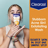 Clearasil Stubborn Acne Control 5in1 Exfoliating Wash, Maximum Strenght with 2% Salicylic Acid Acne Treatment Medicine, Daily Acne Facial Cleanser 6.78 fl oz