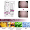 RtopR Mango Stretch Marks and Scar Cream -Stretch Marks and Scar Removal Cream for Pregnancy - Best Body Moisturizer-40g