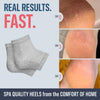 Dr. Frederick's Original Moisturizing Heel Socks for Cracked Heel Treatment - 2 Pairs - Stop Cracked Heels in Their Tracks