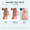 Purederm Exfoliating Heel Mask (1 Pair) - Heel Peeling masks gently remove calluses from your heel