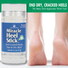 Miracle Heel Stick with Pure UltraAloe Aloe Vera Gel | 2.5 ounce stick