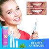 DIAREGNO Teeth Whitening Pen (2 Pens) - 20+ Uses, Effective ? Painless, No Sensitivity - Beautiful White Smile - Natural Mint Flavor