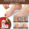 Toenail Fungus Treatment Nail Repair Solution: Toenail Fungus Treatment Extra Strength - Nail Fungus Treatment for Toenail - Contains Tea Oli - Safely and Gently- 30ml